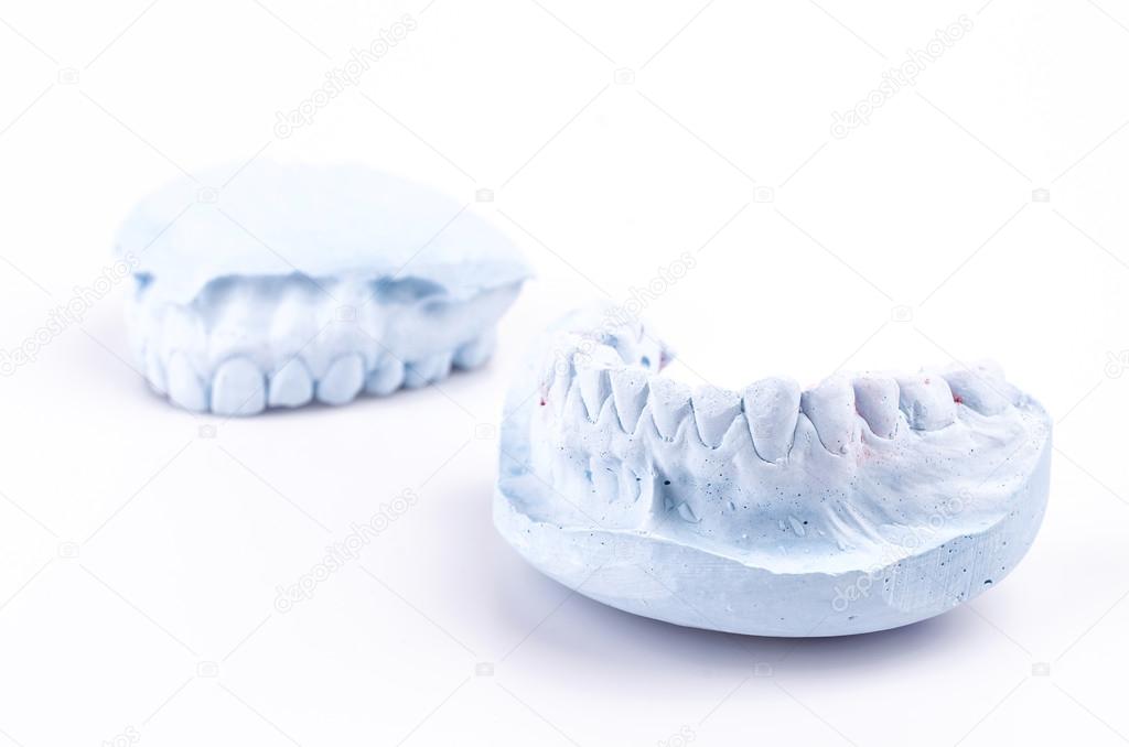 Teeth mold Stock Photo by ©mrsiraphol 36689593